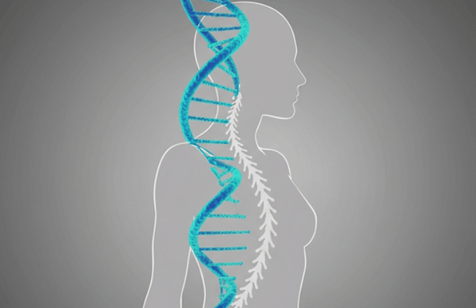 Genetic and Lifestyle Factors Influencing Scoliosis and Bracing
